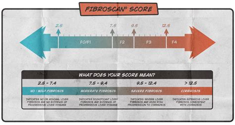 fibroscan score calculator.